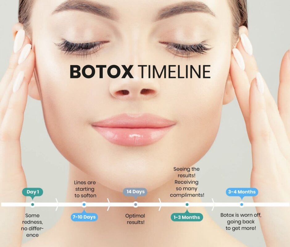 botox timeline